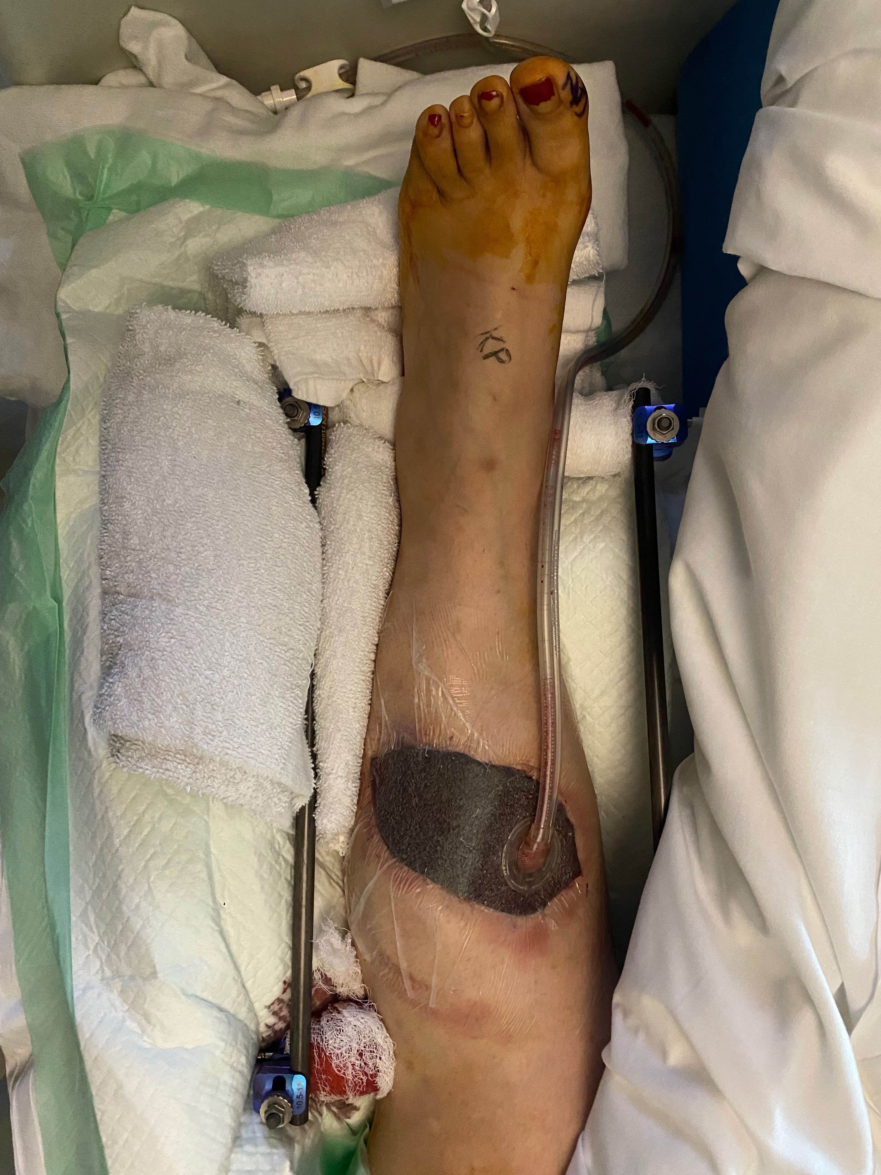 Support Maria’s Recovery After Road Rage Incident campaign photo, 6 of 7