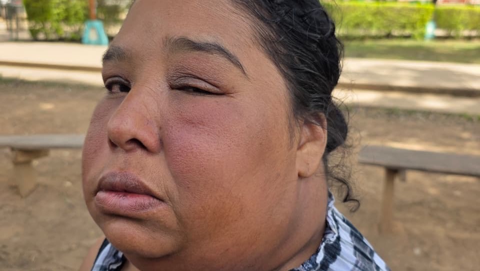 Esperanza para Heidi: Juntos por su Recuperación photo