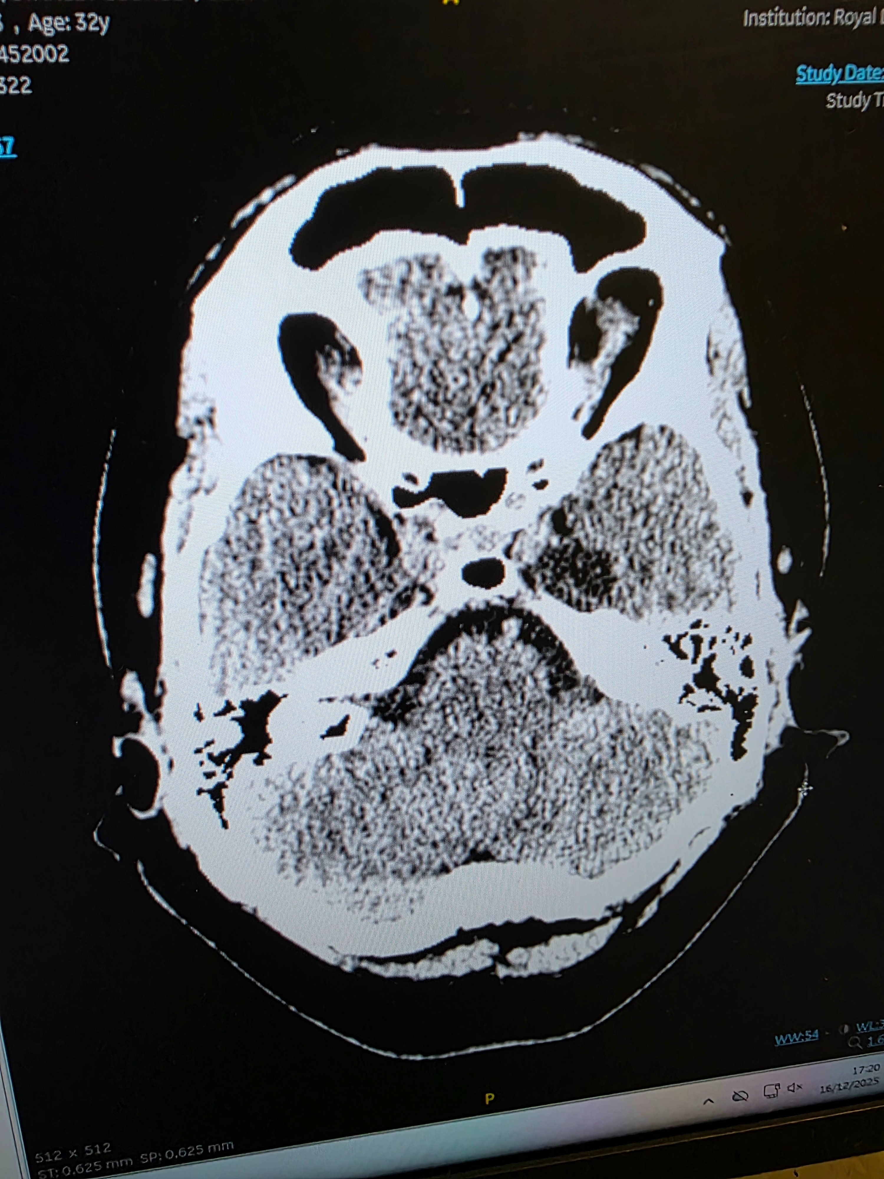 Help Peter rebuild life after a brain tumour diagnosis campaign photo, 4 of 5