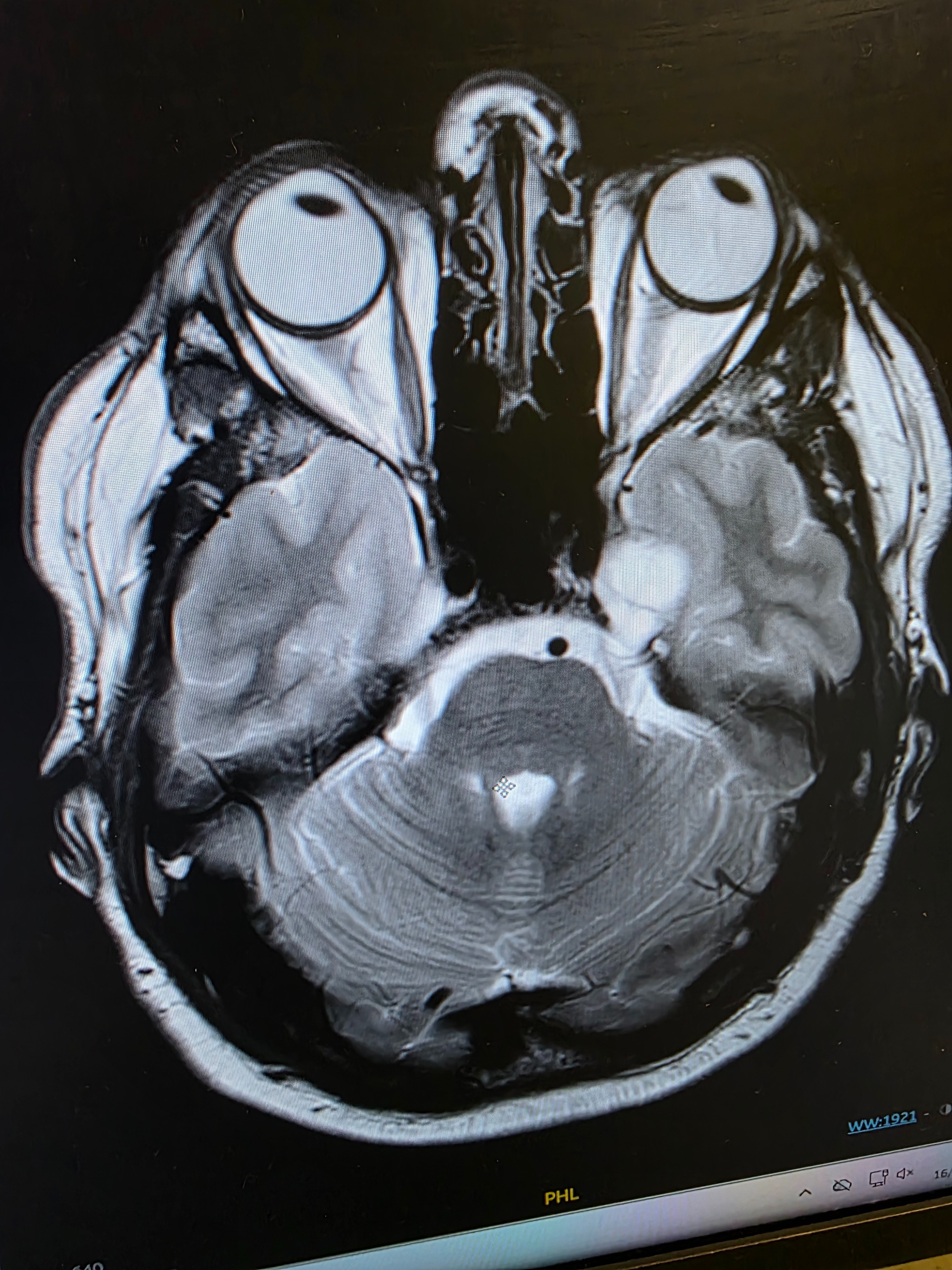 Help Peter rebuild life after a brain tumour diagnosis campaign photo, 2 of 5