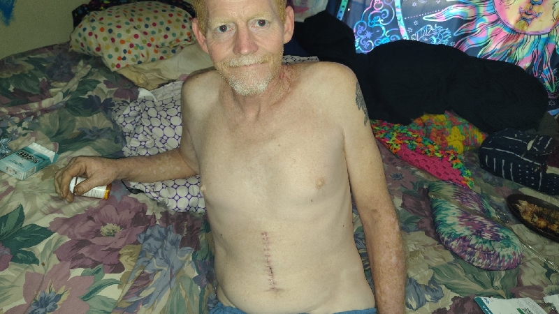 HELP SAVE OUR HOME AFTER ROB'S MEDICAL NEGLECT. photo