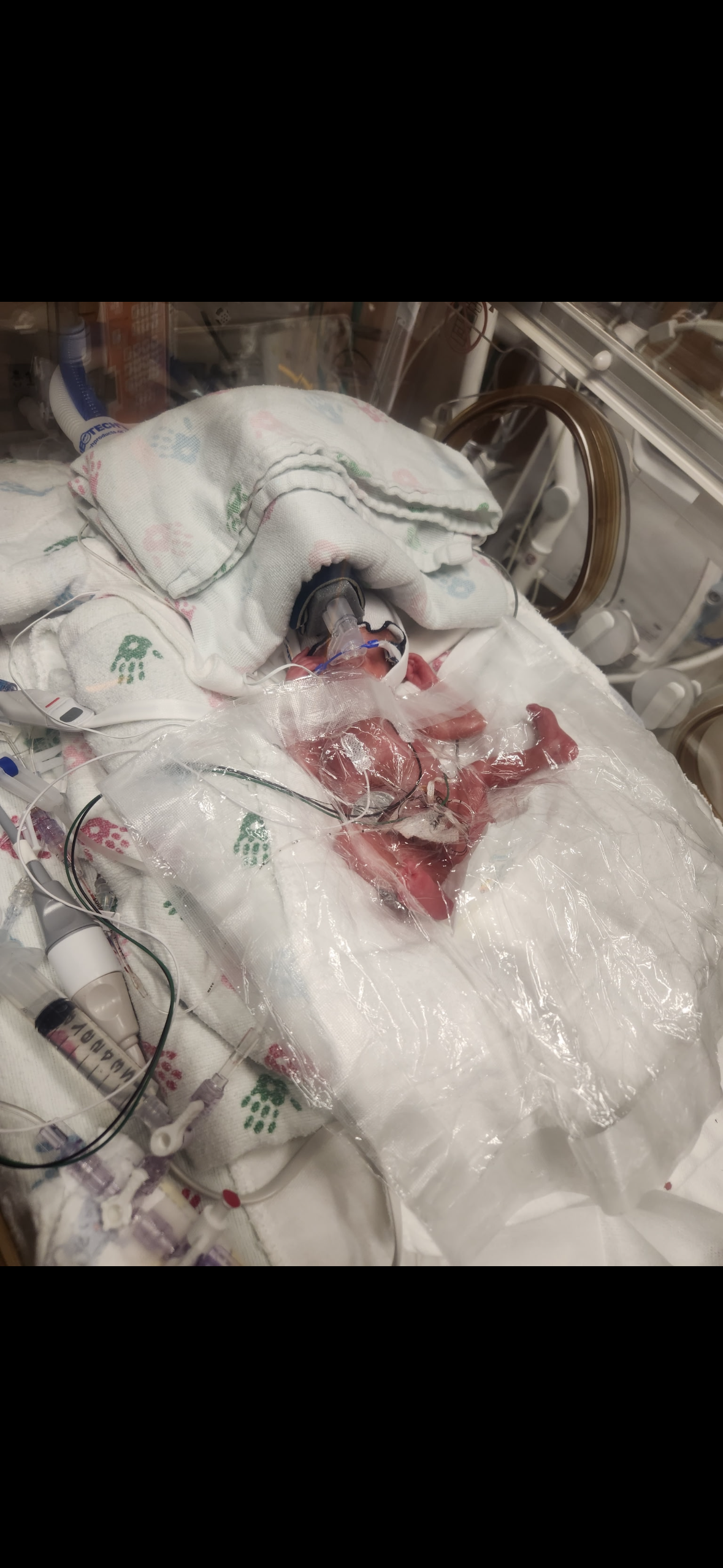 Help Faith and her family in Baby Colt’s Loss campaign photo, 2 of 8
