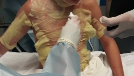 Help My Son Recover After House Fire