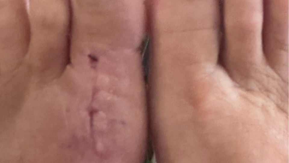 Support Donna’s Recovery After Work Injury