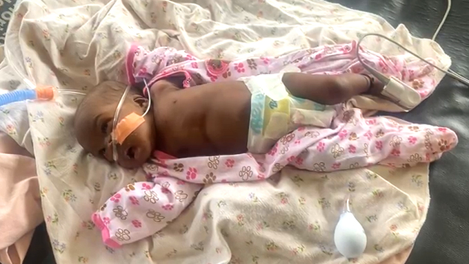 Save baby Dillan give her a chance to see the world photo