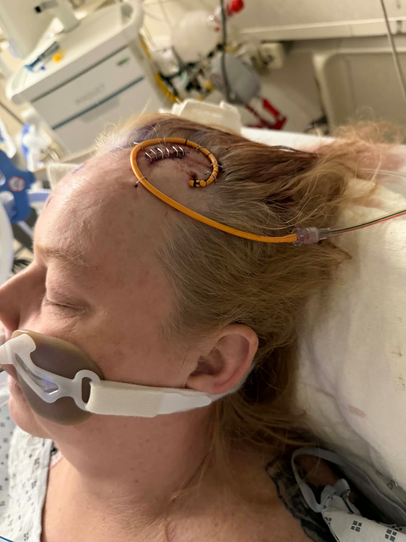 Support Trish's Recovery After Brain Aneurysm campaign photo, 7 of 8
