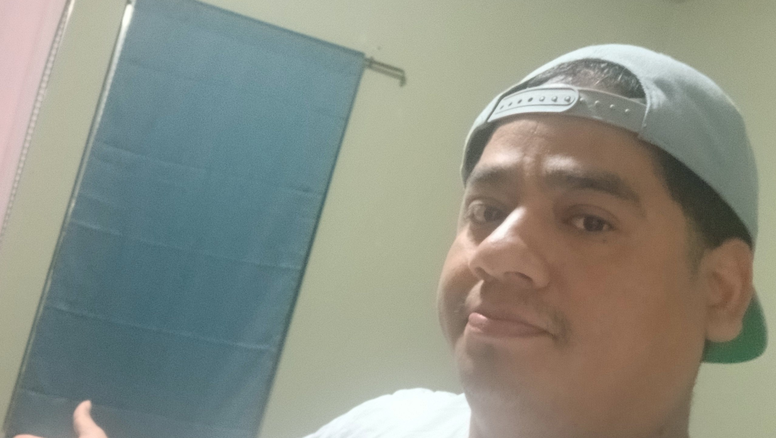 Wisdom tooth removal photo