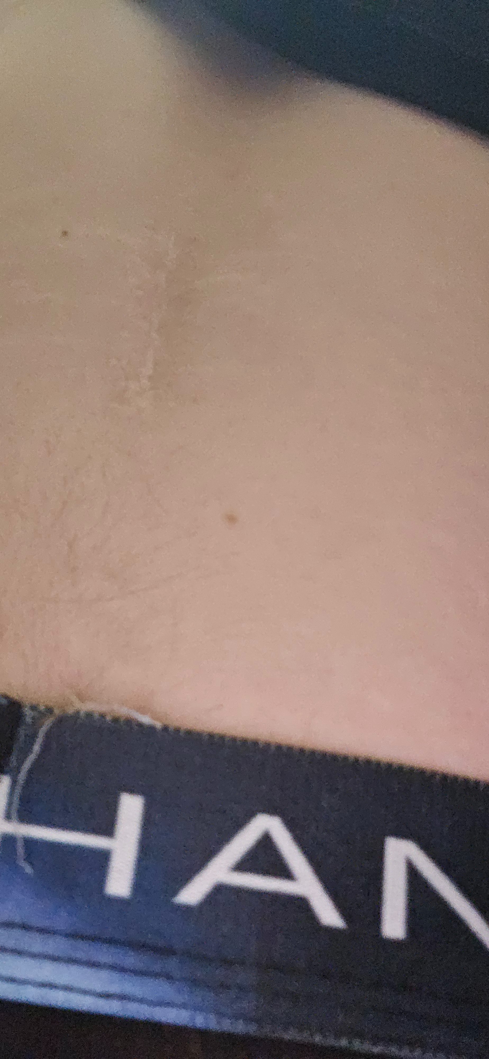 Support Brian’s Family After Loss & Surgery campaign photo, 7 of 8