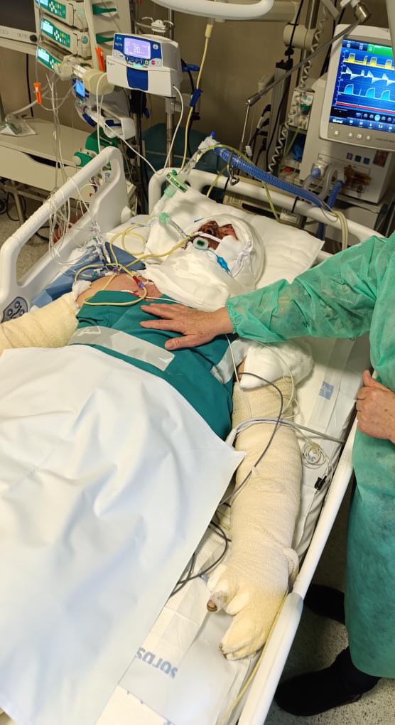Help Predrag Recover from Devastating Burns campaign photo, 7 of 8