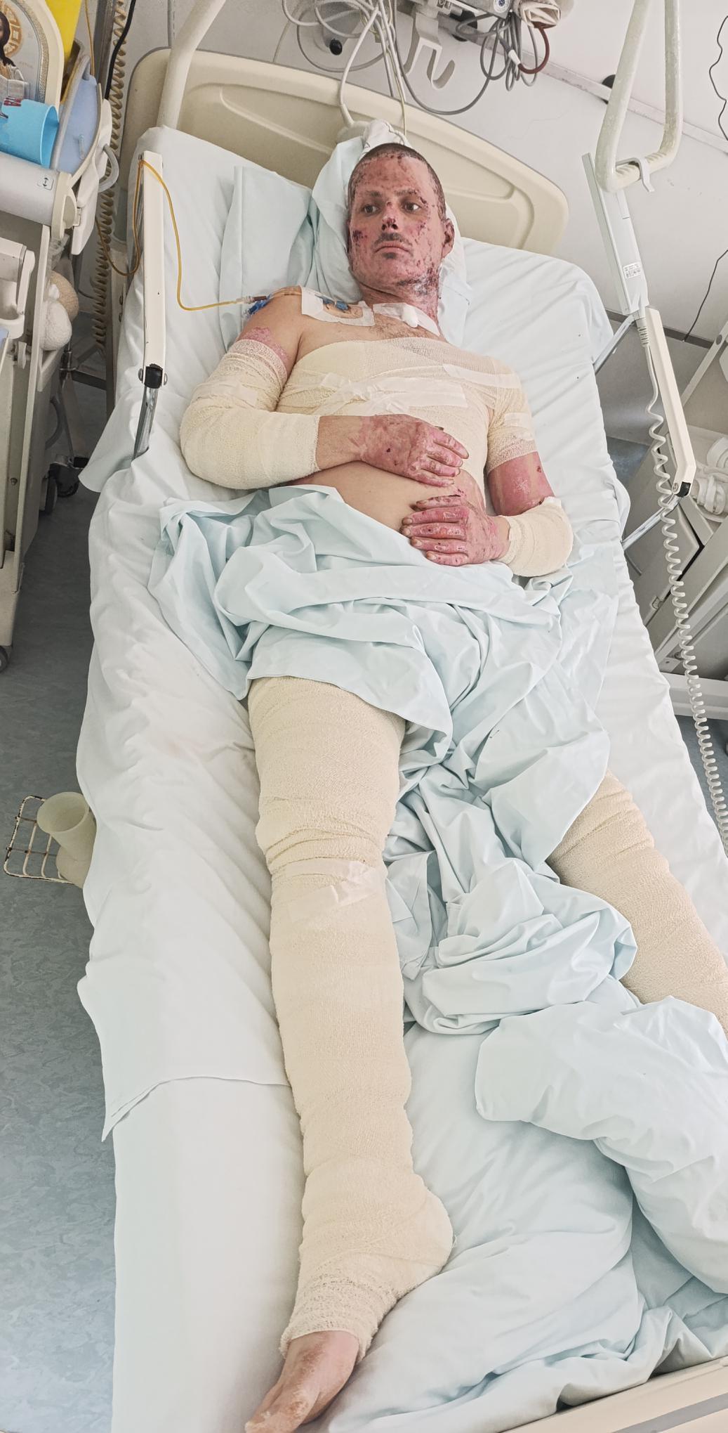 Help Predrag Recover from Devastating Burns campaign photo, 5 of 8