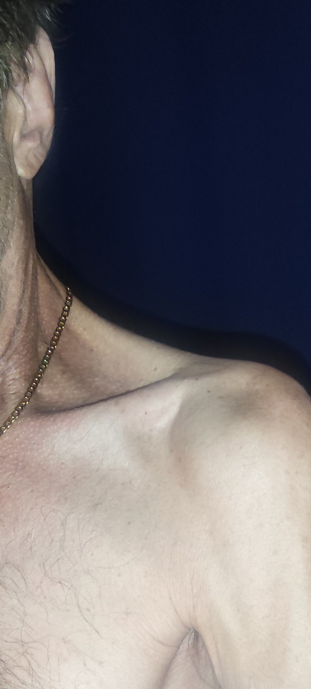 Help David restore his arms and hands movement campaign photo, 2 of 5