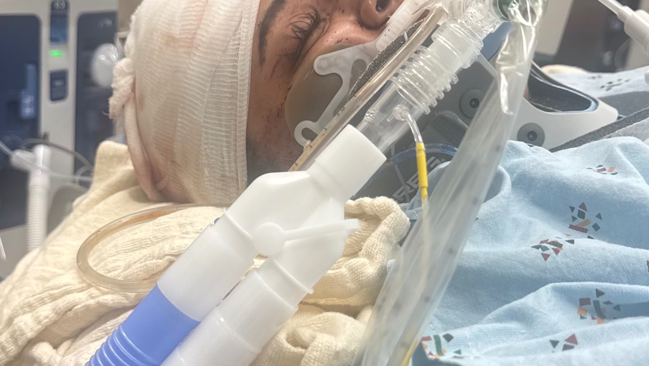 Emergency Medical Fund Fighting To Keep Her Vision photo