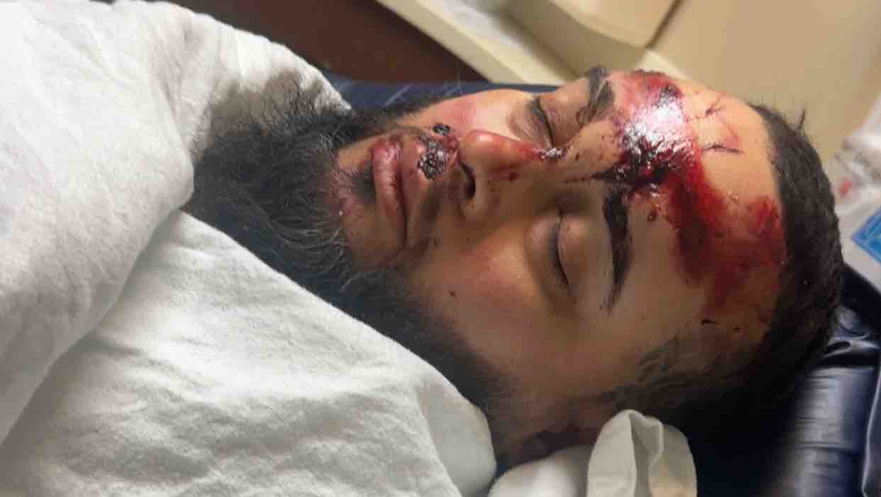 Help Me Recover After a Devastating Accident