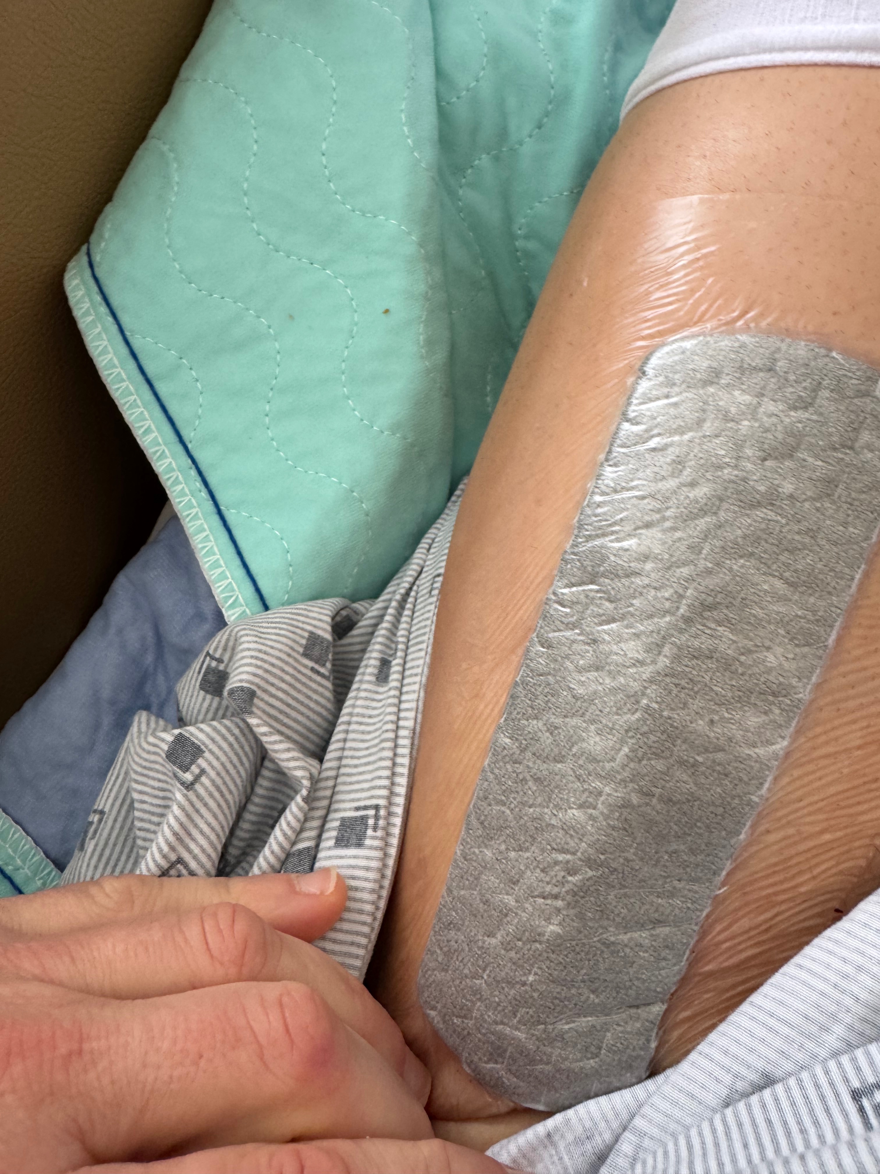 My Journey Through Double Hip Replacement campaign photo, 4 of 7