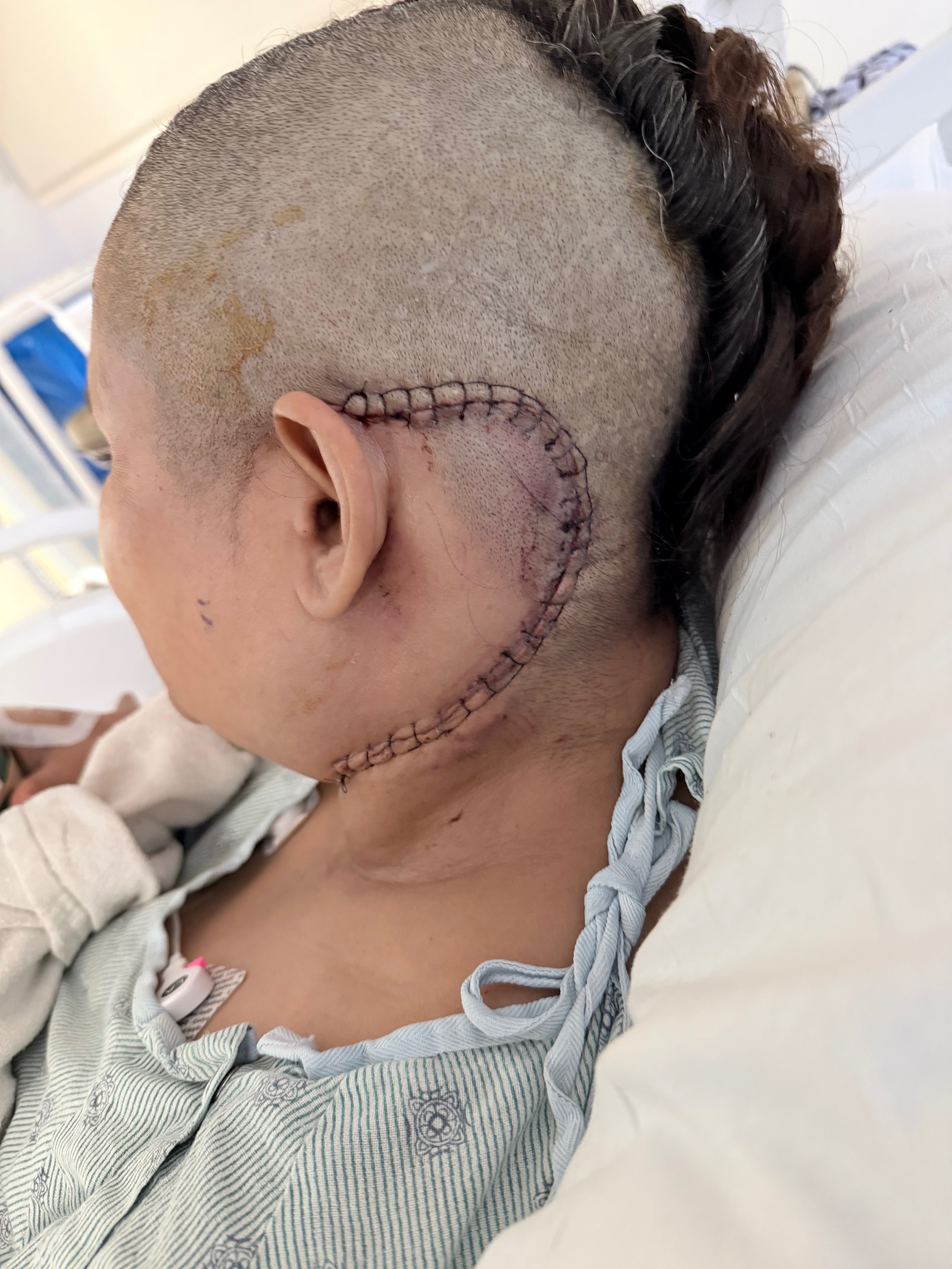 Support Claudia's Fight Against Chiari Malformation campaign photo, 2 of 6