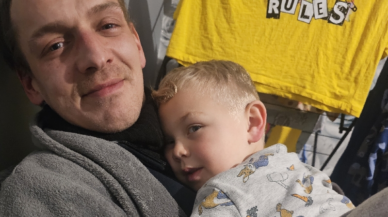 Grade 4 giloma (brain tumer) photo