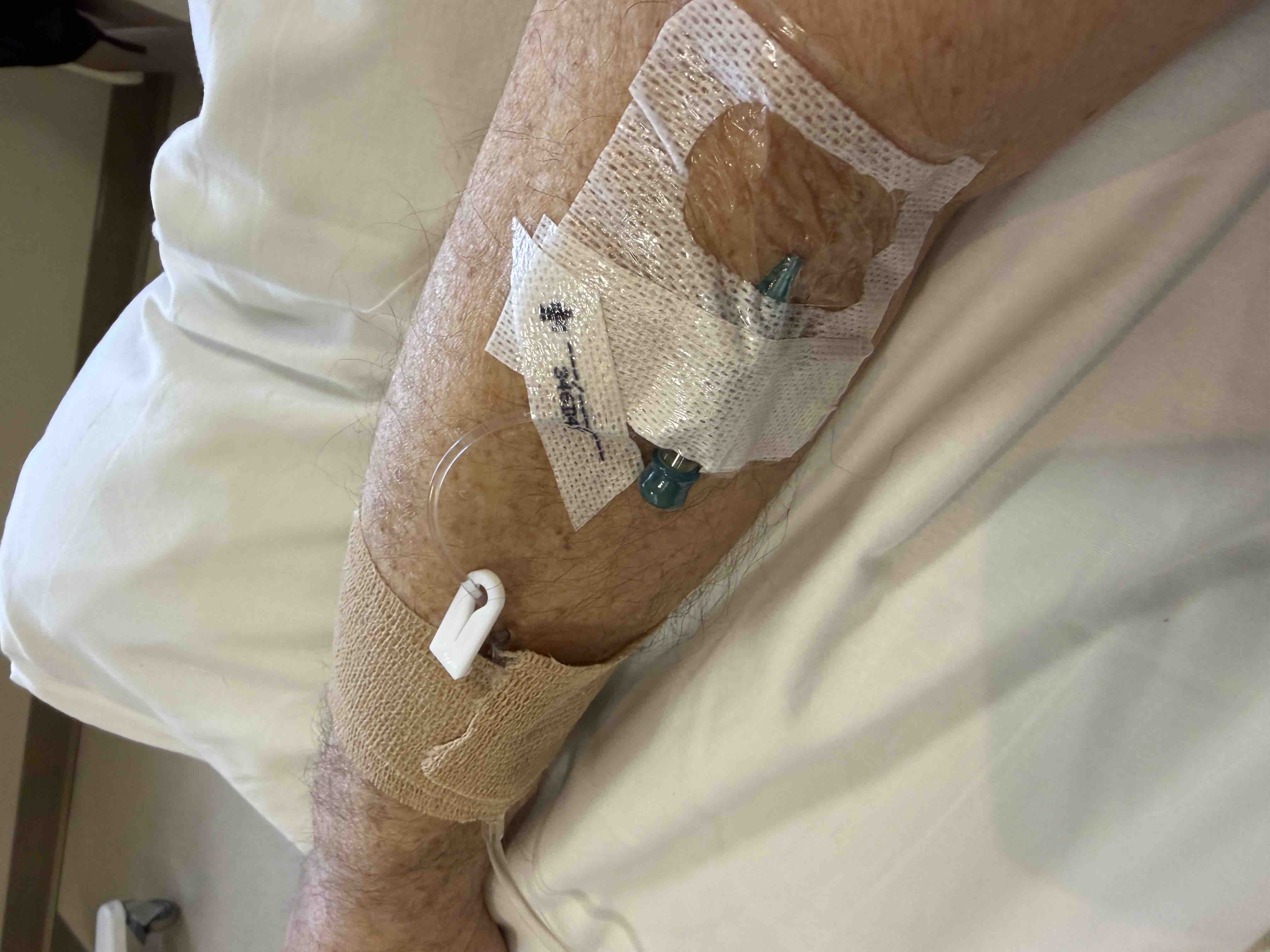 Support Alan’s Cancer Recovery campaign photo, 6 of 7