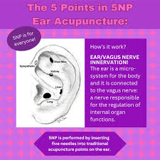 Support Santi Bringing 5NP Acupuncture to Community campaign photo, 4 of 7