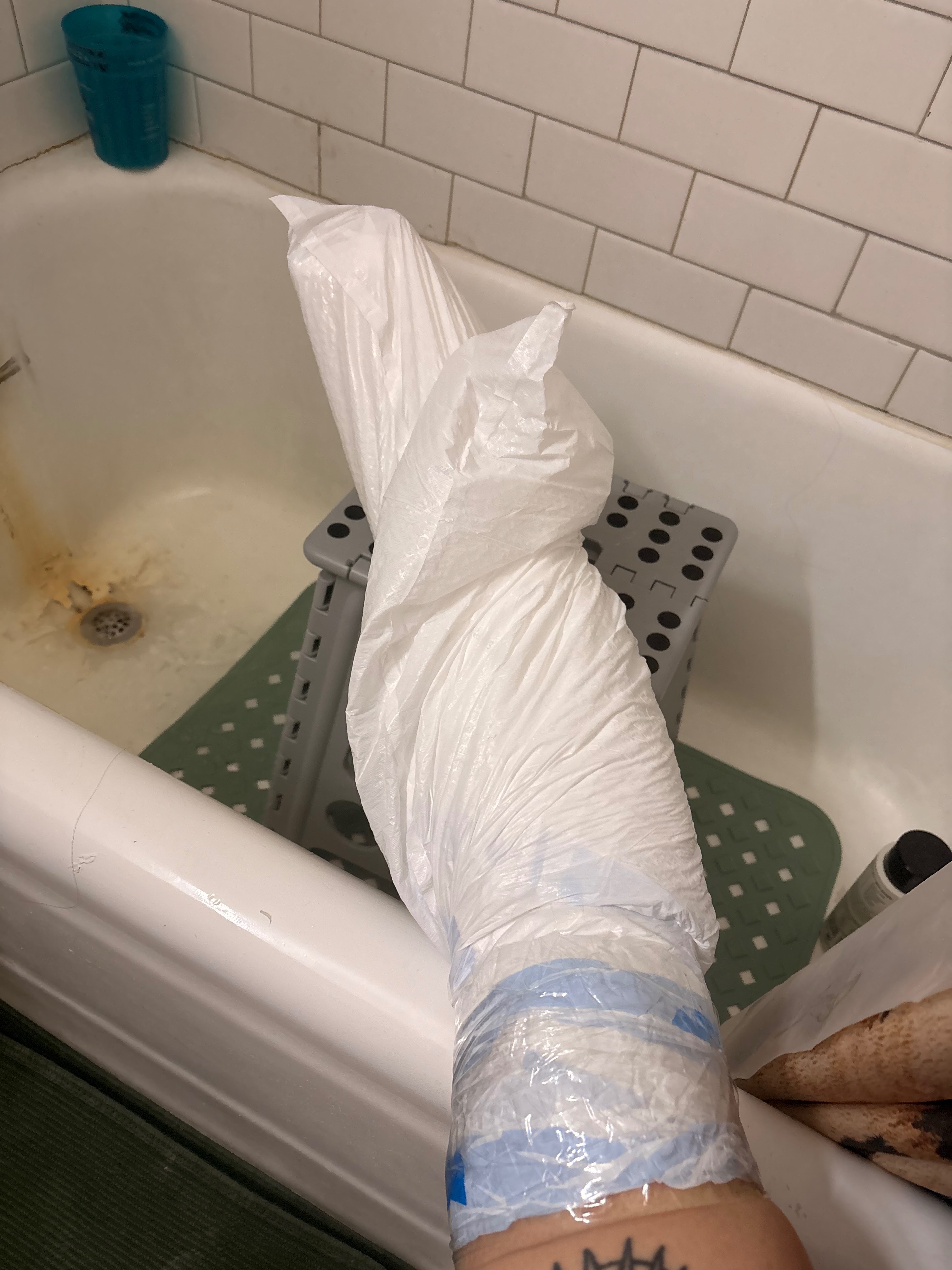 Help Cover Bills After My Ankle Injury campaign photo, 2 of 6