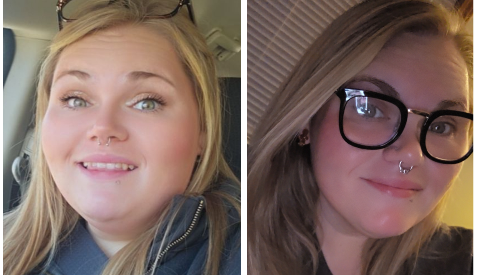 Help Shelby Feel Confident After Weight Loss photo