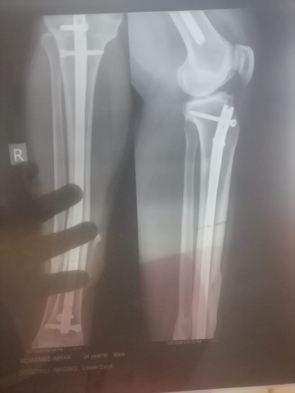 Urgent Surgery for Imran campaign photo, 4 of 8