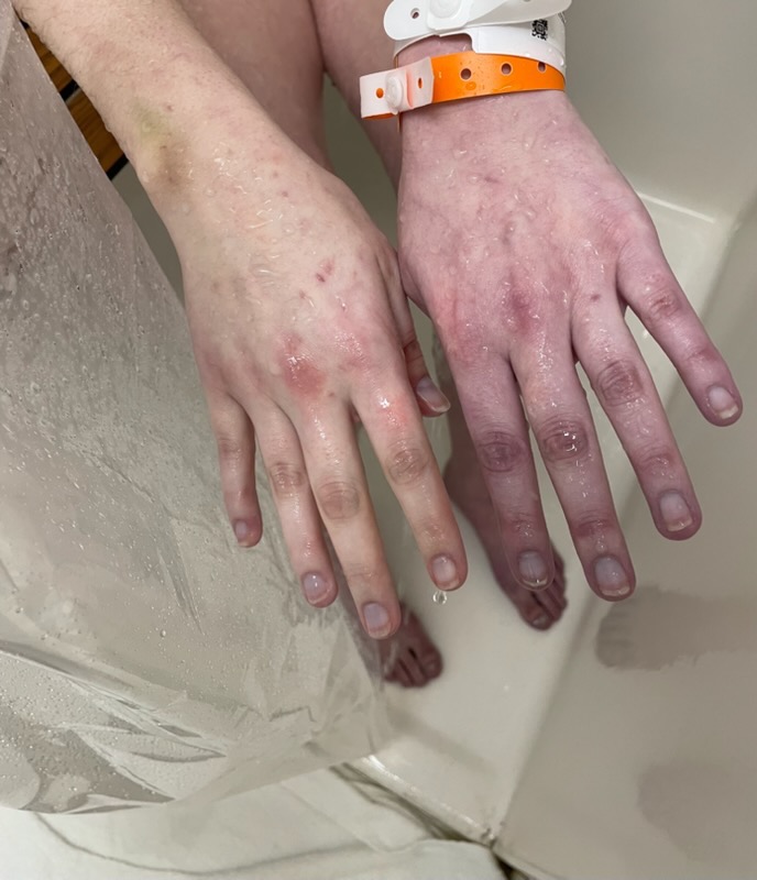 Support Madison’s Fight Against Guillain-Barré Syndrome campaign photo, 7 of 8