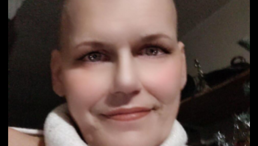 Help Rebecca Fight Cancer & get her breast fixed w home, too photo