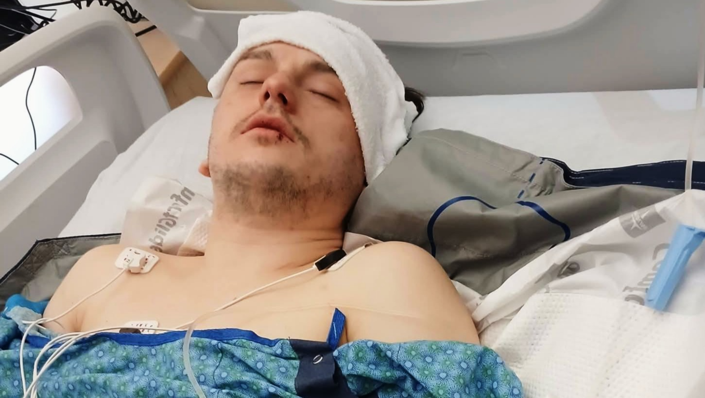 Support Anthony's Recovery after a Violent Hate Crime