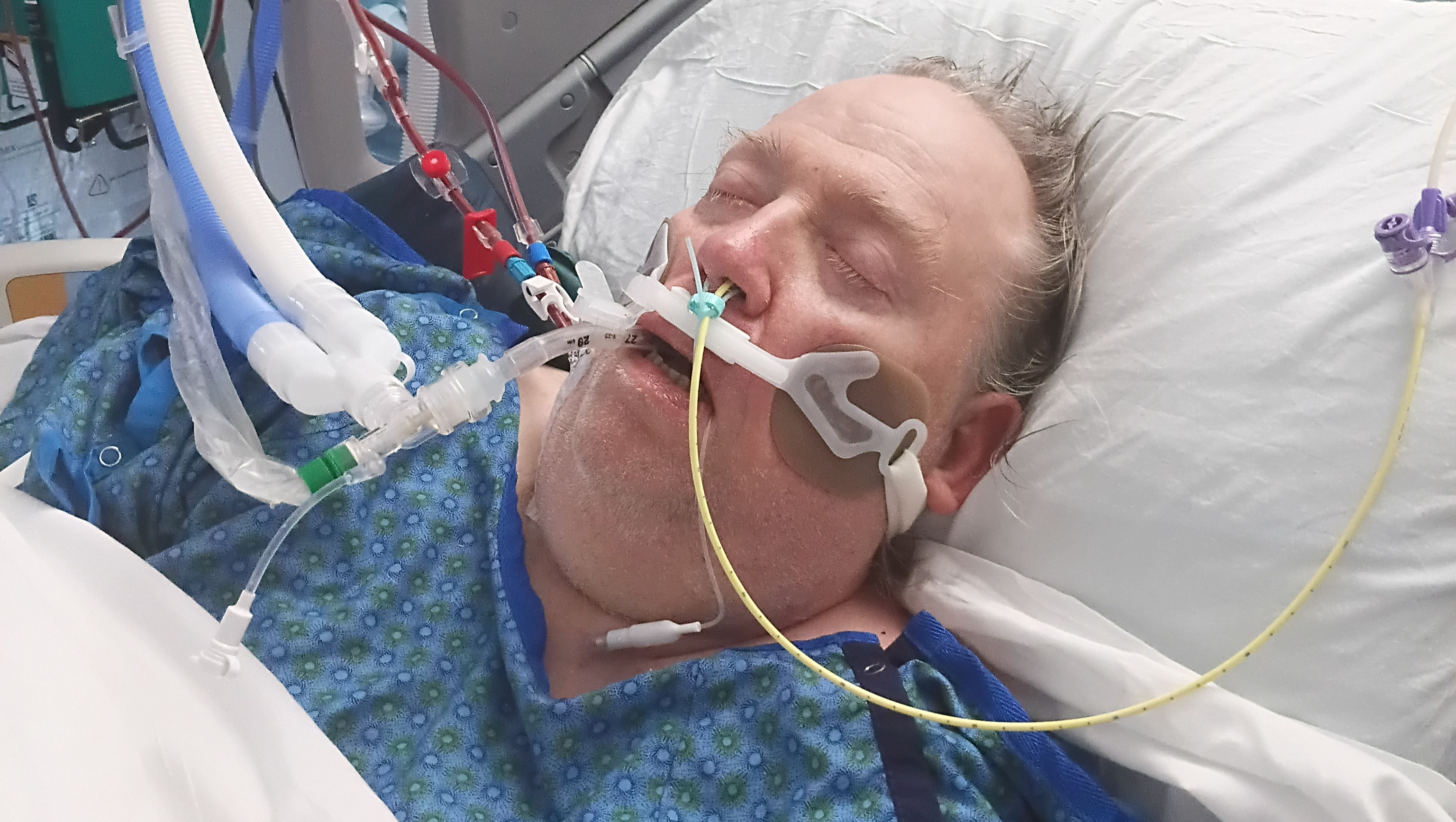 Help Lay Chad to Rest photo