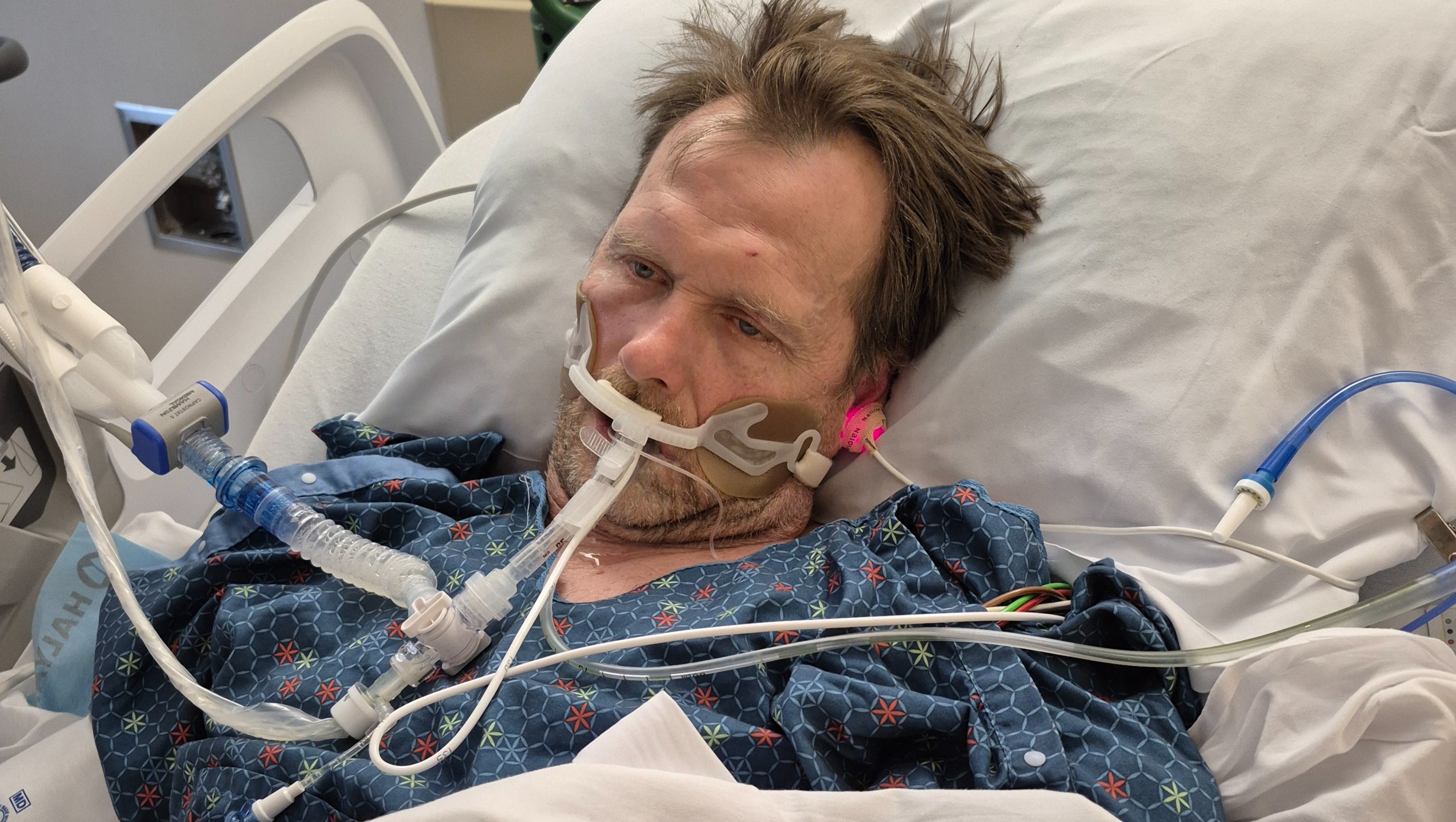 Help Mike Recover After Devastating Stroke foto