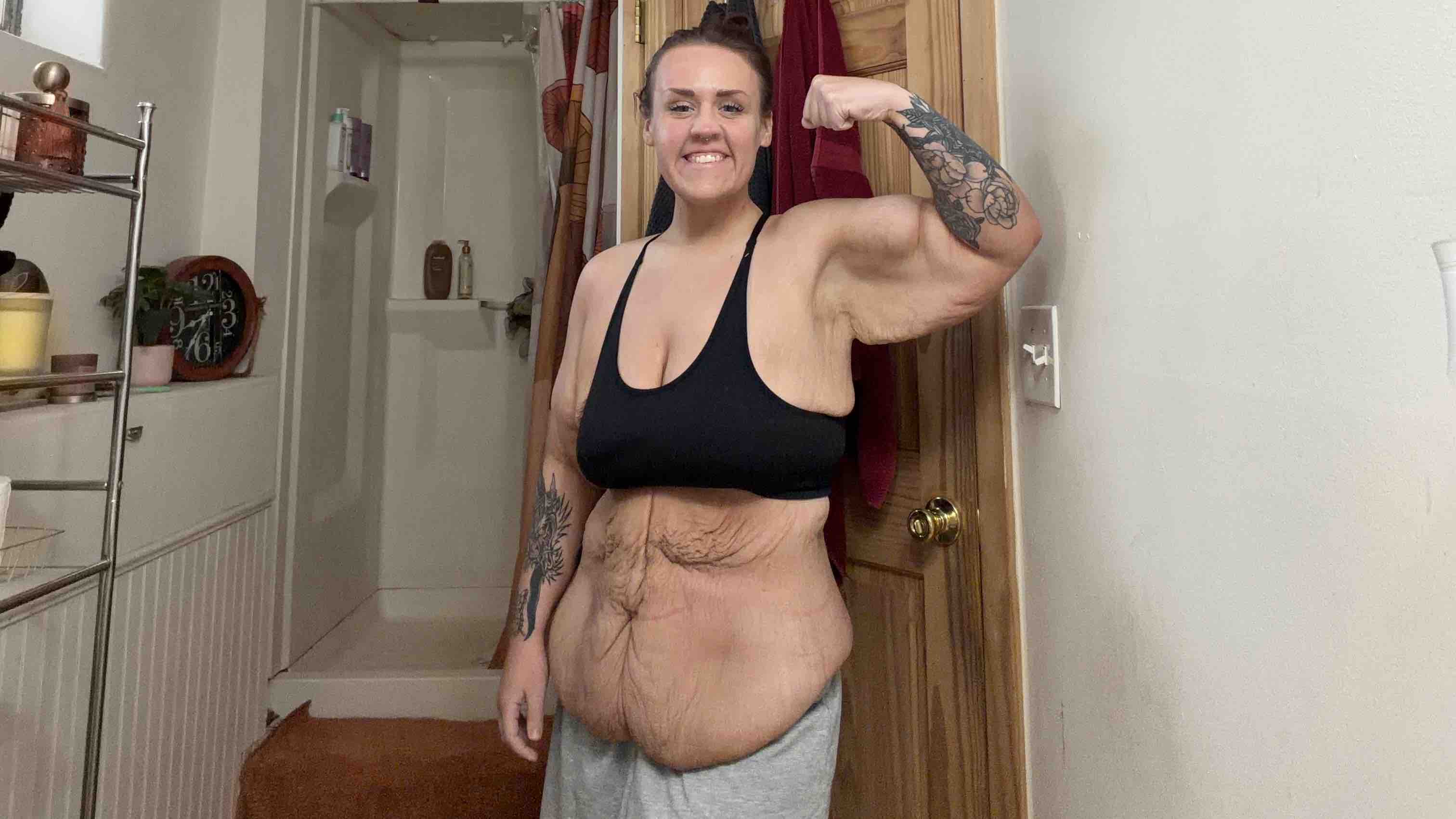Help Me Complete My 264-Pound Weight Loss Journey photo