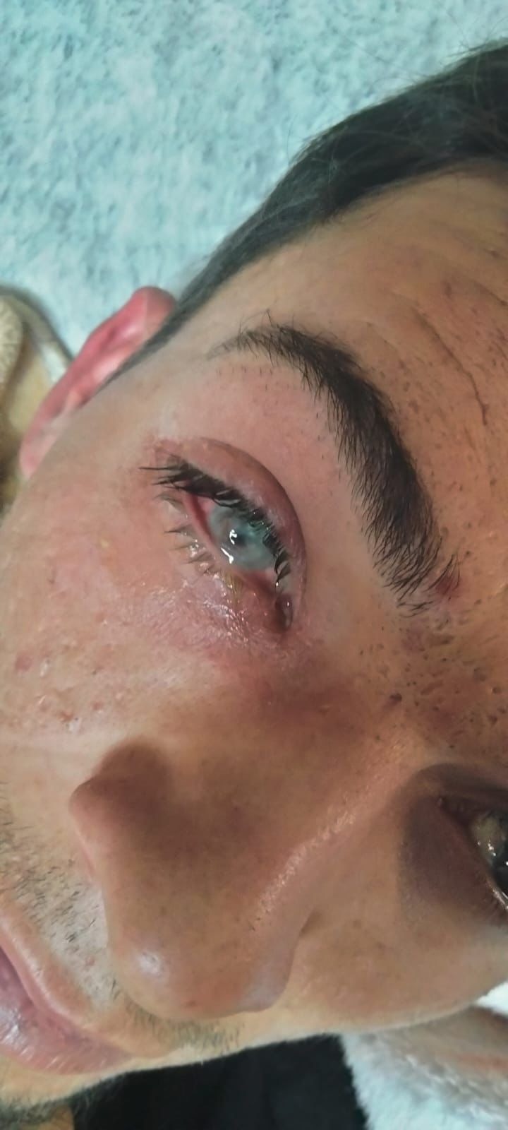 Fundraiser by Heidi Hernandez : Help Jose Get a Life-Saving Cornea ...