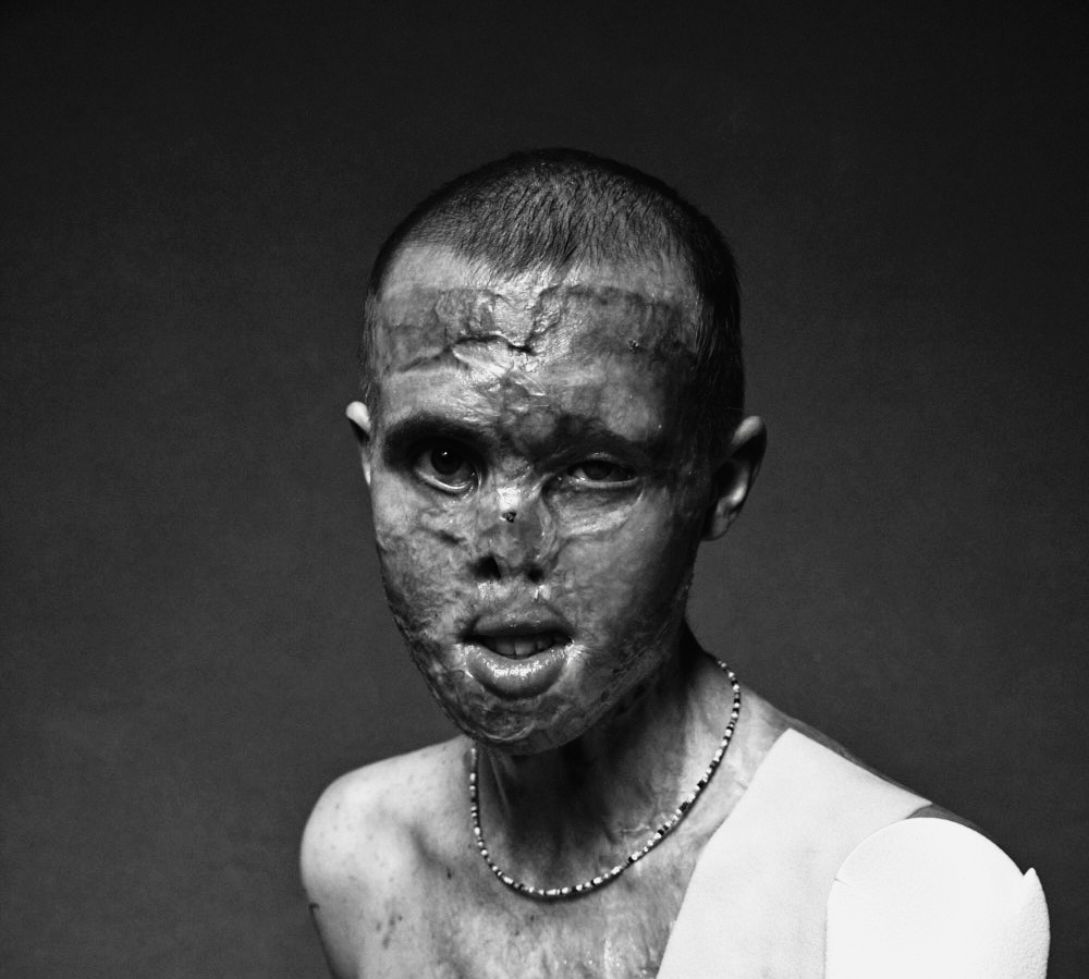 Help me found essential adaptations and surgeries campaign photo, 4 of 8