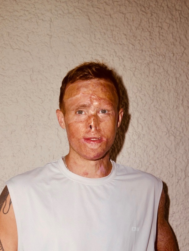Help me found essential adaptations and surgeries campaign photo, 6 of 8