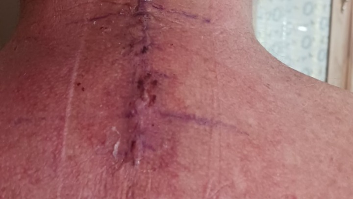 Help Garry Stay on His Feet photo