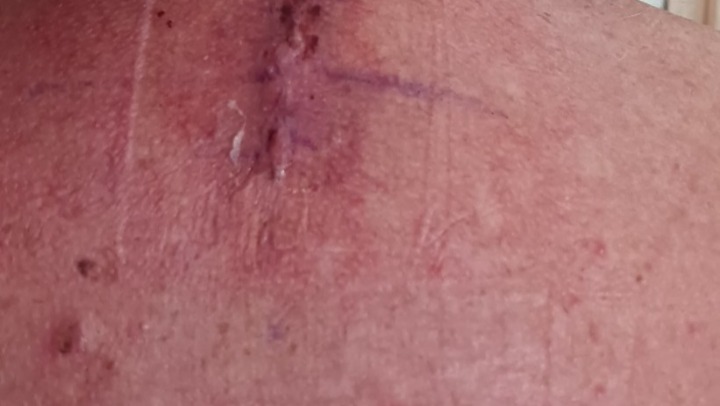 Help Garry Catch Up After Injury Please photo
