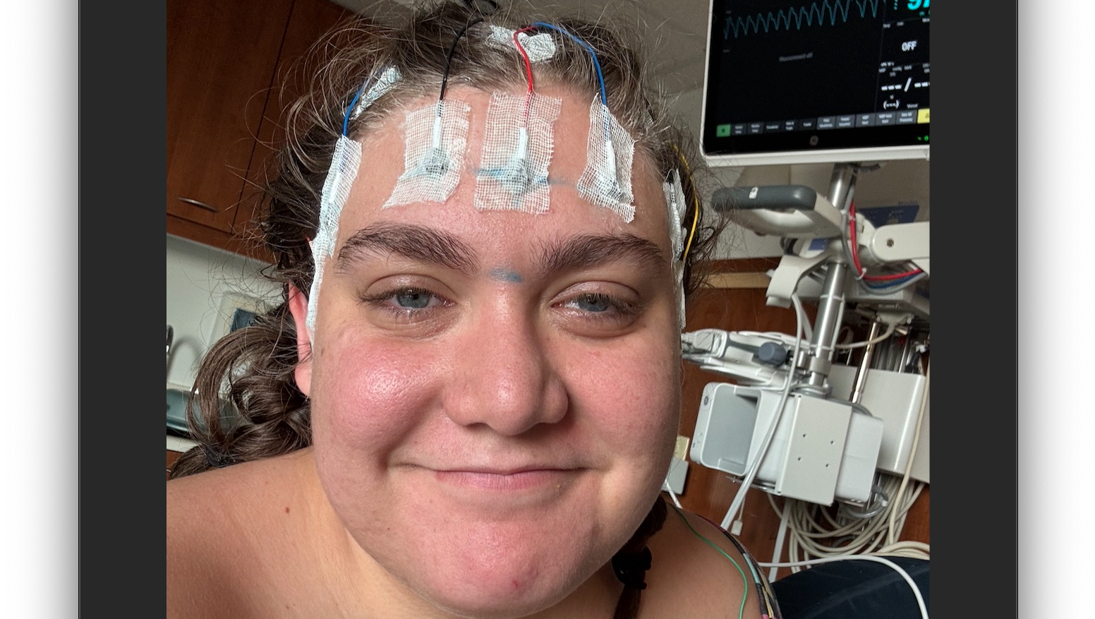 Support for Living with Functional Neurological Disorder