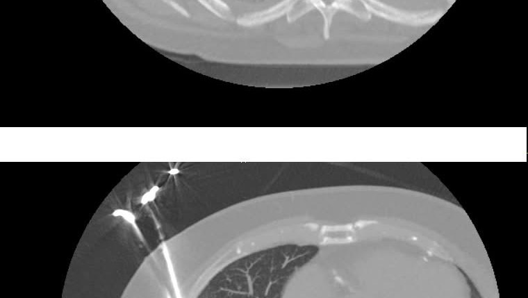 Hospitalisé  photo
