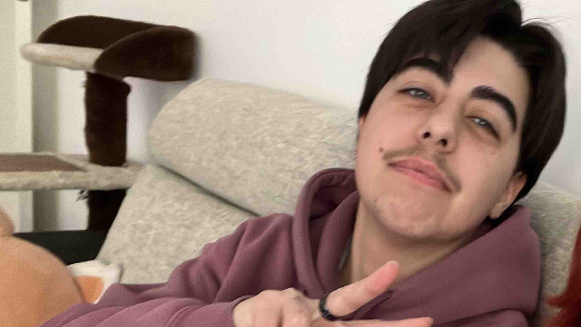 Support my Top Surgery photo