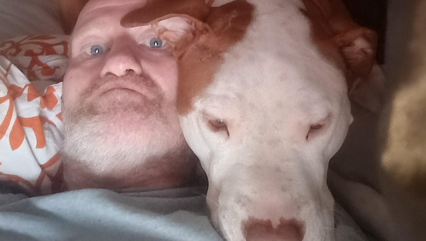 Help Tanner Get Life-Saving Surgery