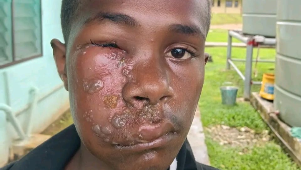 Help heal PNG communities facing unknown toxic threats photo