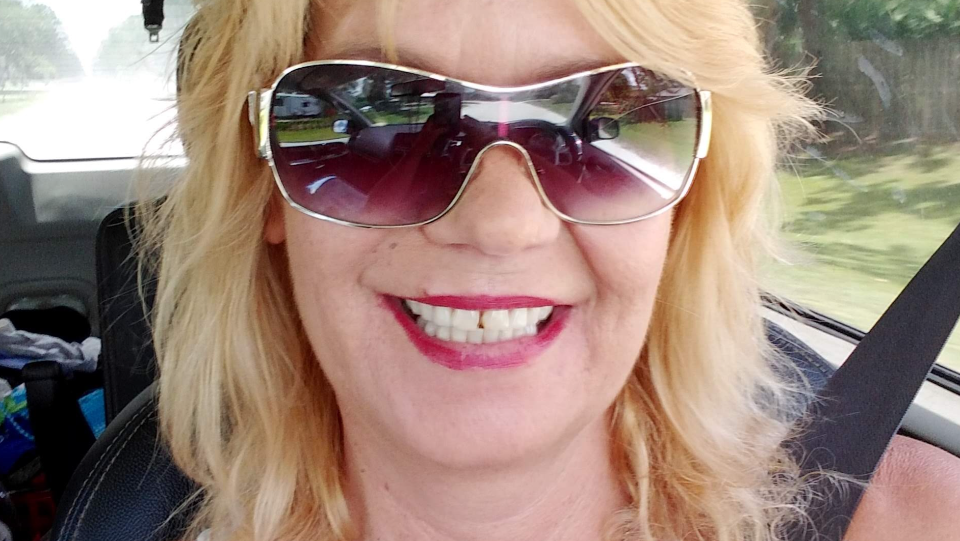 Help Me Smile and Eat Comfortably Again photo
