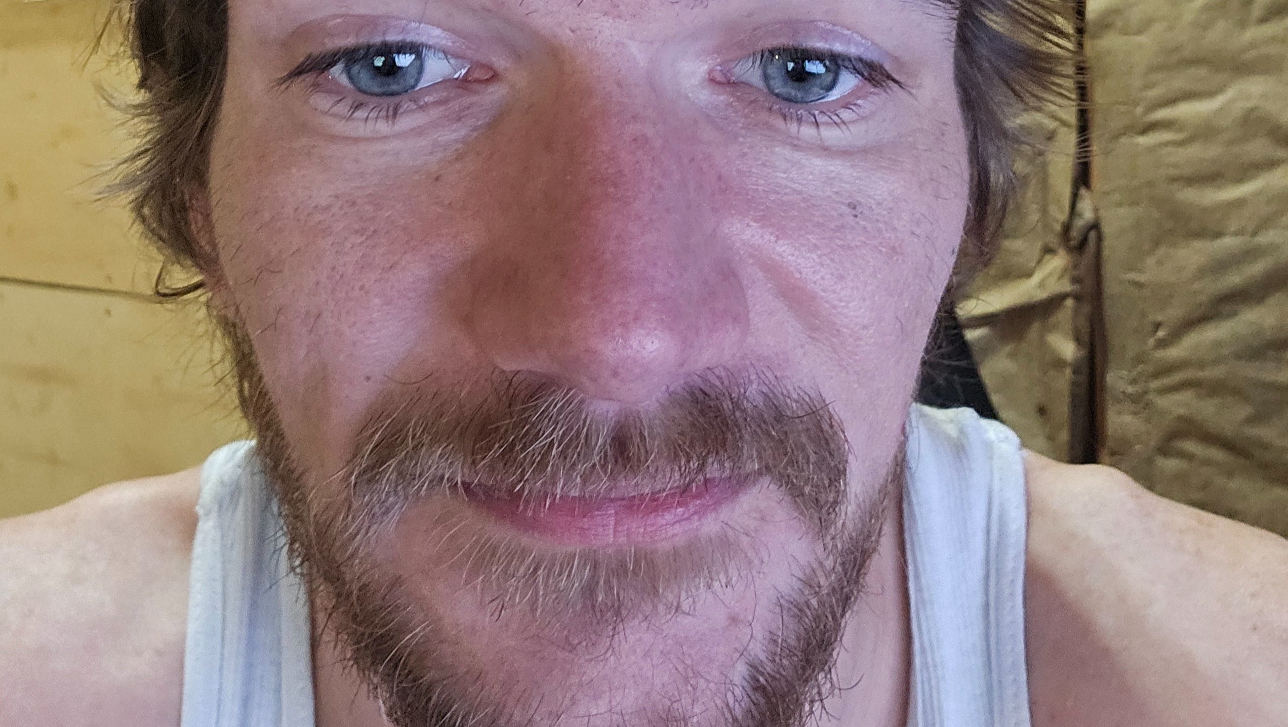 Fundraiser by Tim hodge : Help Tim Smile Again with Dental Implants