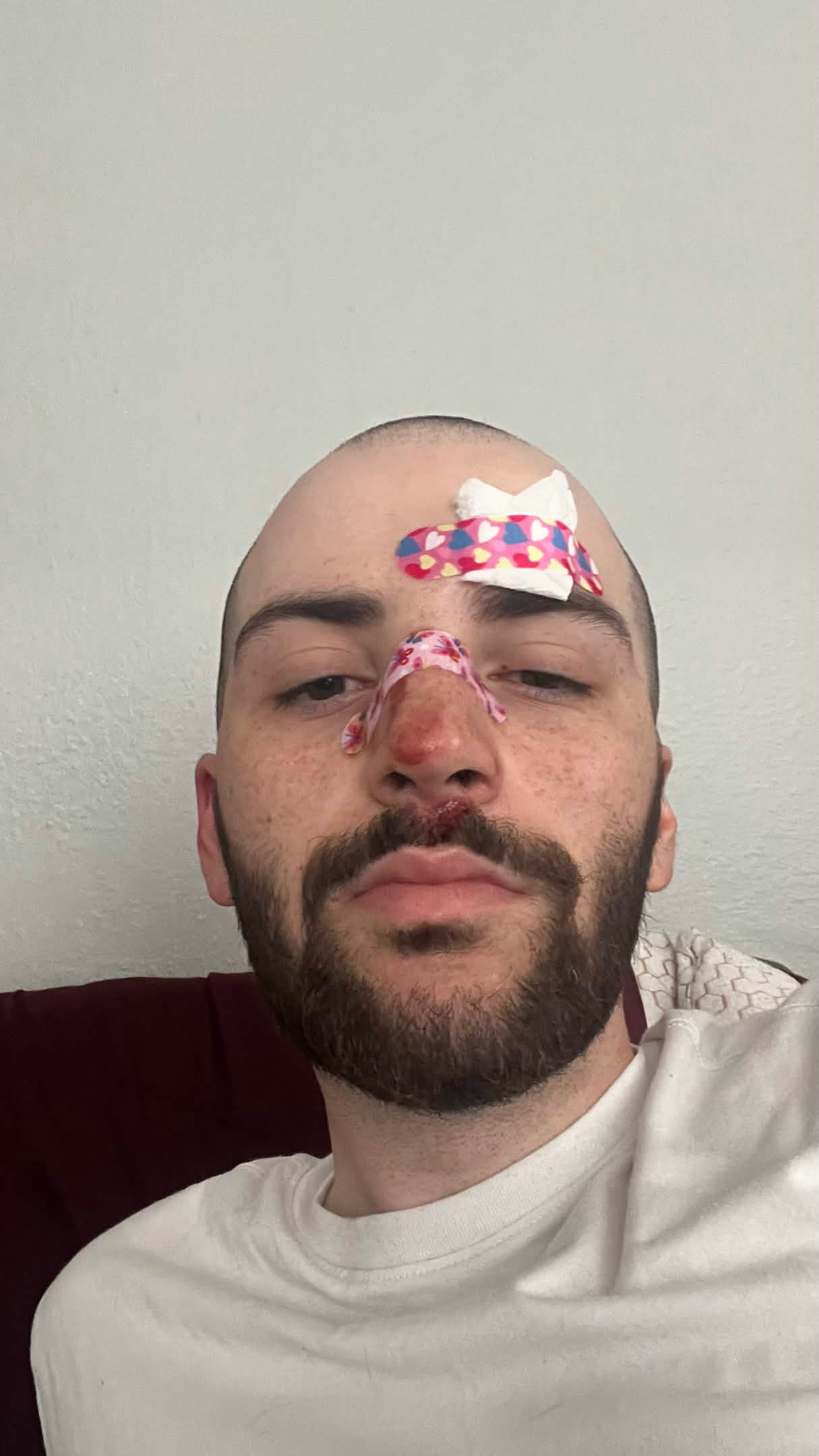 Fundraiser by Joshua Cutrer : Help Joshua Recover After Bike Accident