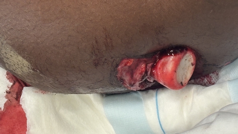 Help Joseph Recover After Car Accident photo