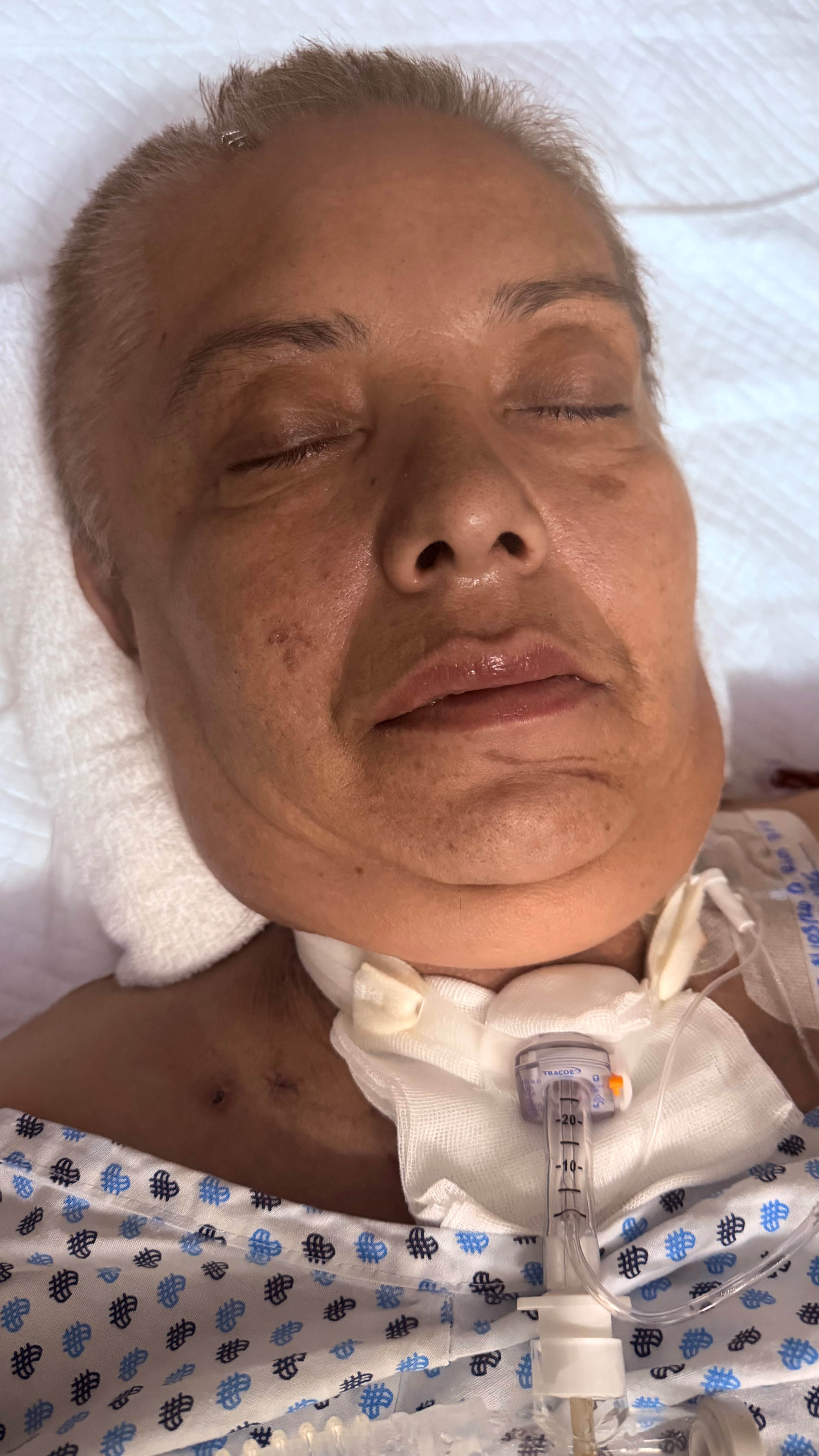Support loving mom in critical condition from hit and run campaign photo, 6 of 8