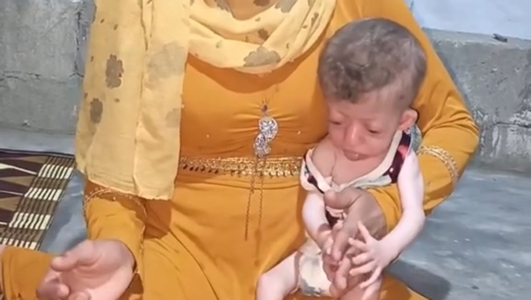 Help Merlic's Family Find Safety and Shelter photo