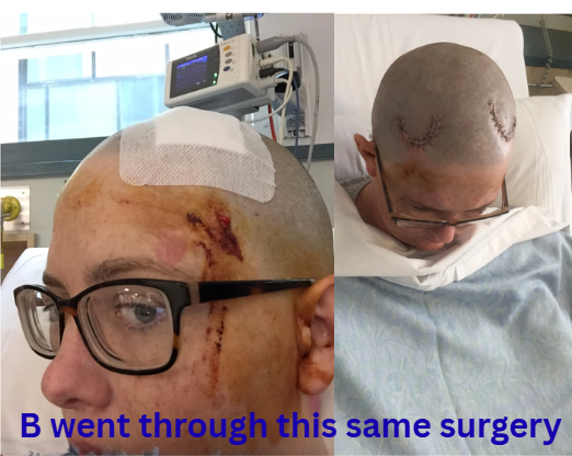 Rare & Painful Brain Implant Complication campaign photo, 4 of 7