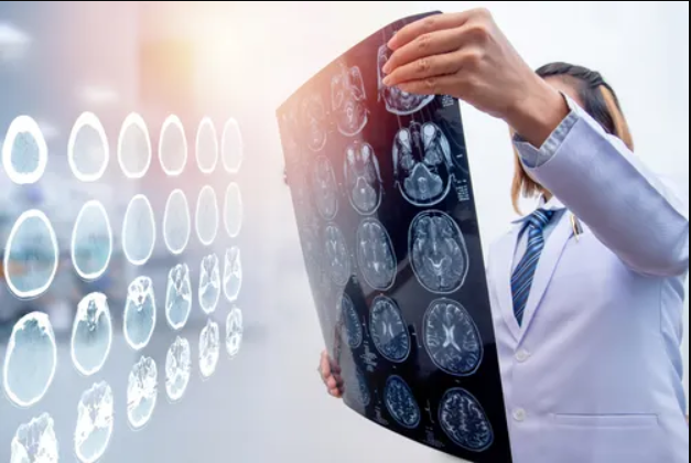 Rare & Painful Brain Implant Complication campaign photo, 6 of 7