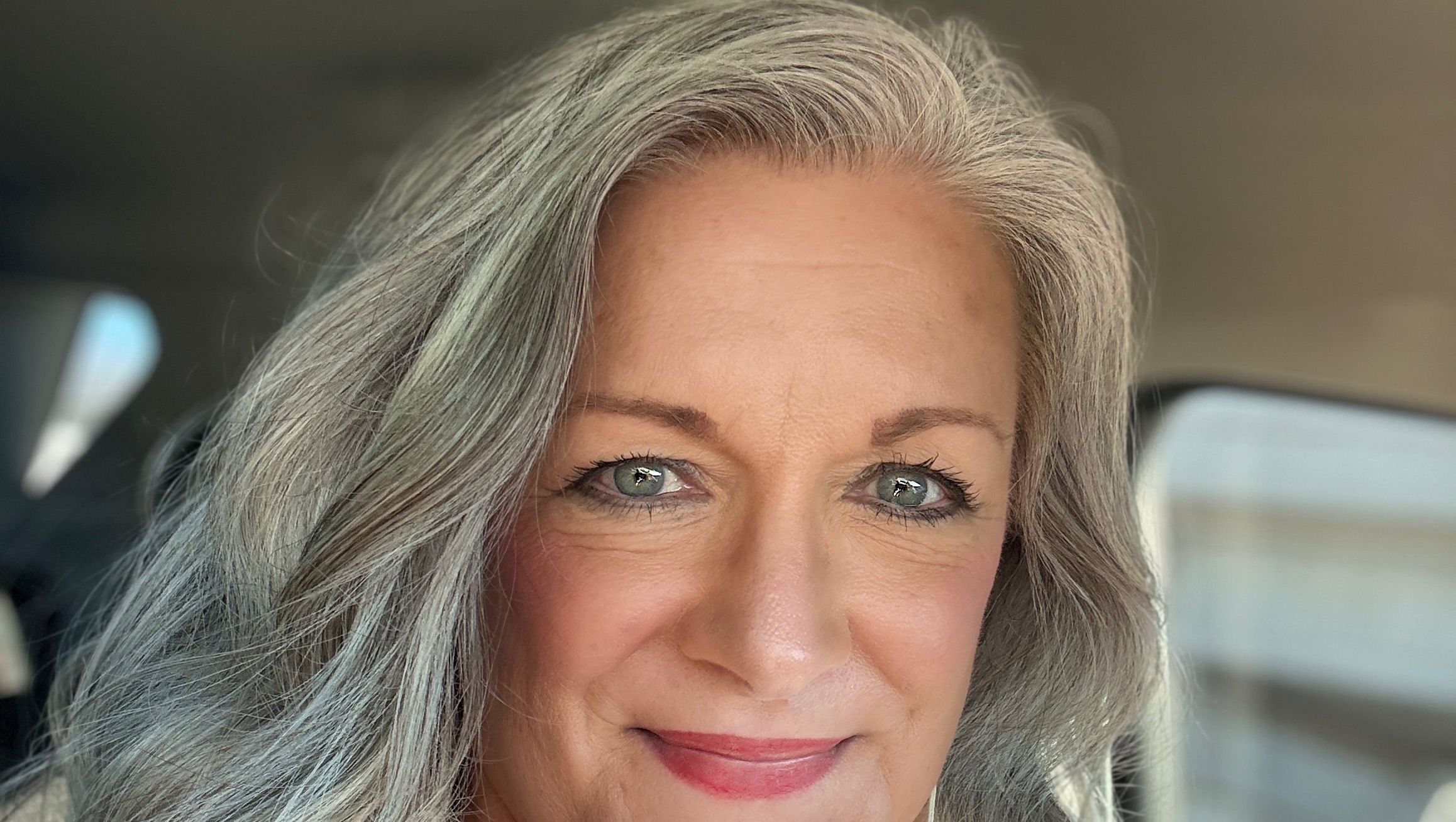 Help Theresa Get Urgent Dental & Medical Care photo